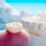 WHAT IS A DENTAL CROWN?
