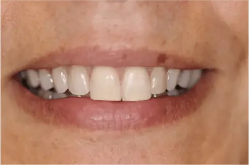 Before Cosmetic Dentistry Treatment Image 1
