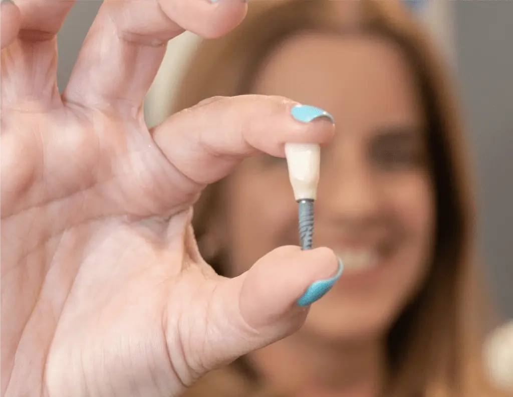 Dental Implant Services