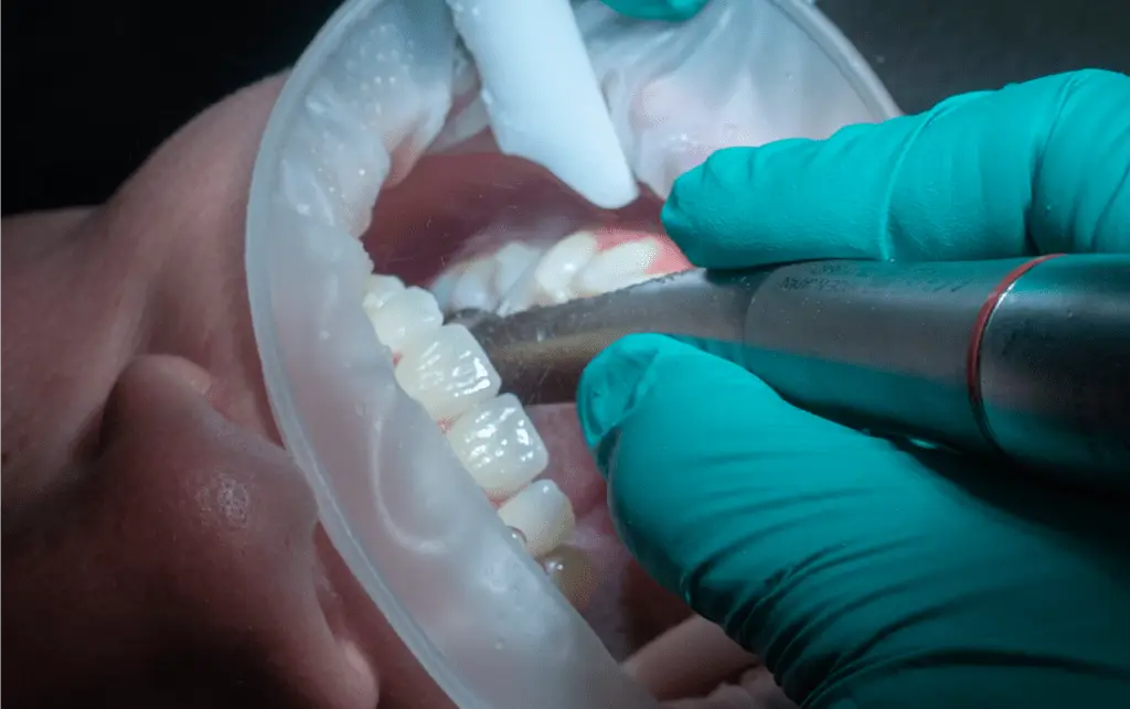 Conscious Oral Sedation
